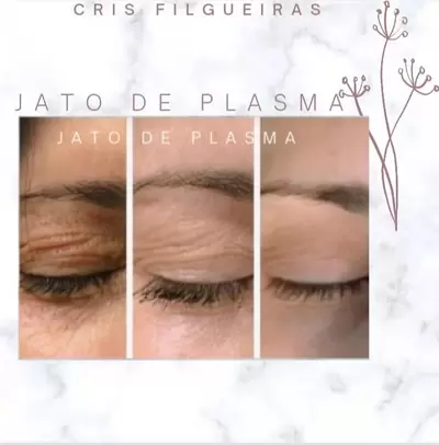 Jato de Plasma