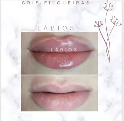 Lábios